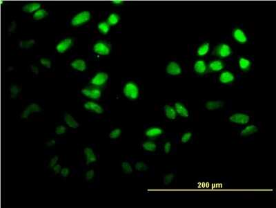Immunocytochemistry/ Immunofluorescence: FoxF2 Antibody (2G10) [H00002295-M04]