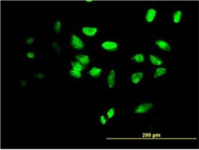 Immunocytochemistry/ Immunofluorescence: FoxF2 Antibody (3F5) [H00002295-M03]