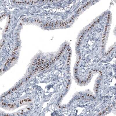 Immunohistochemistry-Paraffin: FoxJ1/HFH4 Antibody (CL3989) [NBP2-59032]