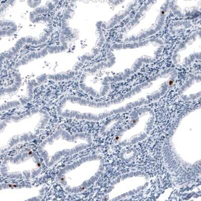 Immunohistochemistry-Paraffin: FoxJ1/HFH4 Antibody (CL3989) [NBP2-59032]