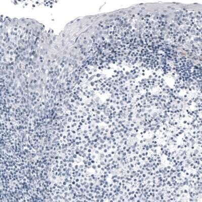 Immunohistochemistry-Paraffin: FoxJ1/HFH4 Antibody (CL3989) [NBP2-59032]