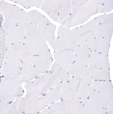 Immunohistochemistry-Paraffin: FoxJ1/HFH4 Antibody (CL3989) [NBP2-59032]