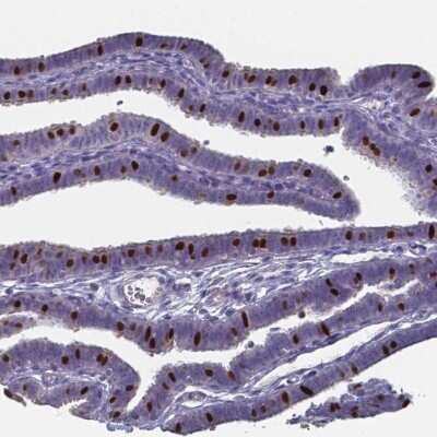 Immunohistochemistry-Paraffin: FoxJ1/HFH4 Antibody [NBP1-87928]