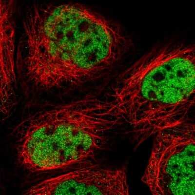 Immunocytochemistry/ Immunofluorescence: FoxK1 Antibody [NBP1-83109]