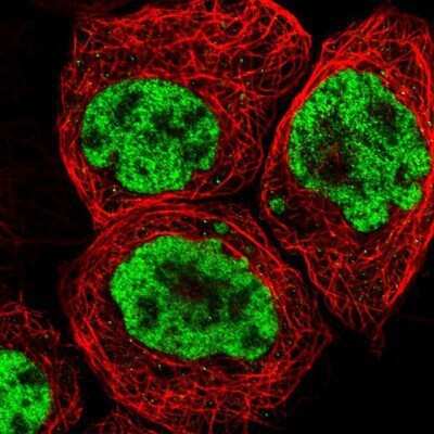 Immunocytochemistry/ Immunofluorescence: FoxK1 Antibody [NBP1-83110]