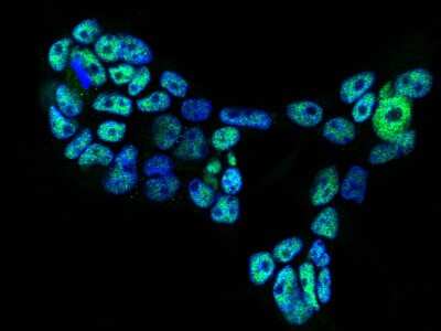 Immunocytochemistry/ Immunofluorescence: FoxK1 Antibody [NBP2-98879]