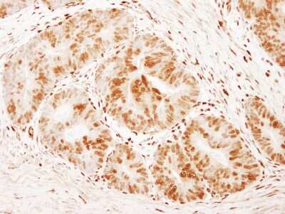 Immunohistochemistry: FoxK1 Antibody [NB100-88145]
