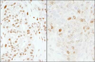 Immunohistochemistry: FoxK1 Antibody [NB100-88146]
