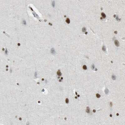 Immunohistochemistry-Paraffin: FoxK1 Antibody [NBP1-83109]