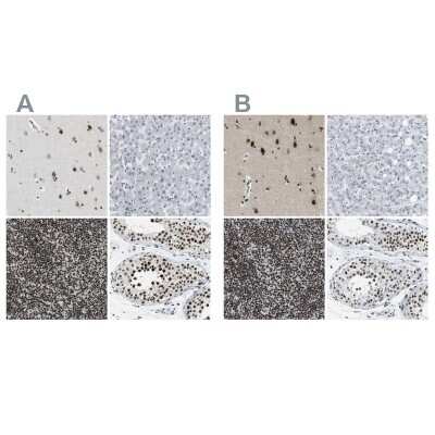 Immunohistochemistry-Paraffin: FoxK1 Antibody [NBP1-83109]