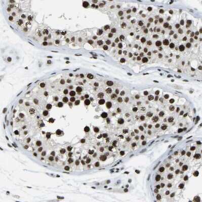 Immunohistochemistry-Paraffin: FoxK1 Antibody [NBP1-83109]