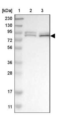 Western Blot: FoxK1 Antibody [NBP1-83109]