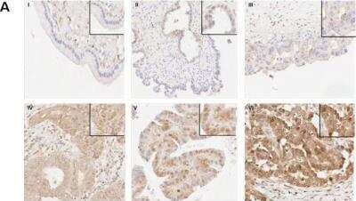 Immunohistochemistry-Paraffin: FoxM1 Antibody [NBP1-30961]