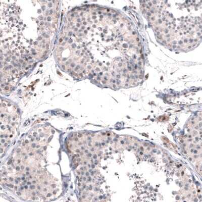 Immunohistochemistry-Paraffin: FoxM1 Antibody [NBP1-84671]