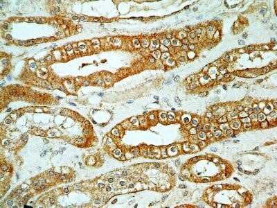 Immunohistochemistry: FoxO1/FKHR Antibody (83N7F8) - Azide and BSA Free [NBP2-80741]
