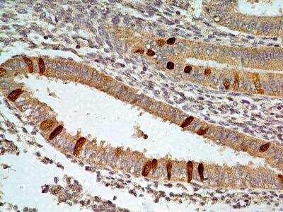 Immunohistochemistry-Paraffin: FoxO1/FKHR Antibody (83N7F8) - BSA Free [NBP2-31376]