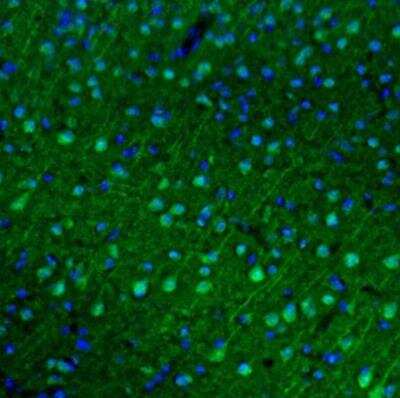 Immunohistochemistry: FoxO1/FKHR Antibody [NBP1-84674]