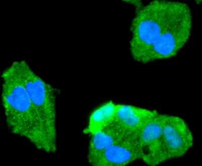 Immunocytochemistry/ Immunofluorescence: FoxO1/FKHR Antibody (SU33-01) [NBP2-67463]