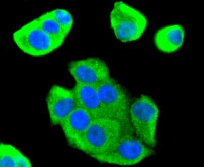 Immunocytochemistry/ Immunofluorescence: FoxO1/FKHR Antibody (SU33-01) [NBP2-67463]