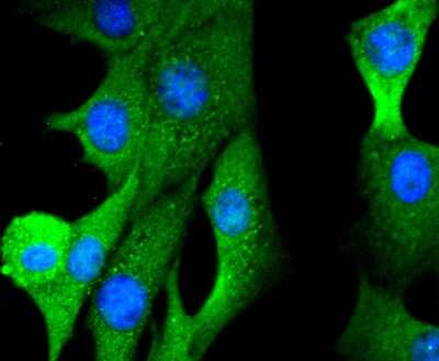 Immunocytochemistry/ Immunofluorescence: FoxO1/FKHR Antibody (SU33-01) [NBP2-67463]