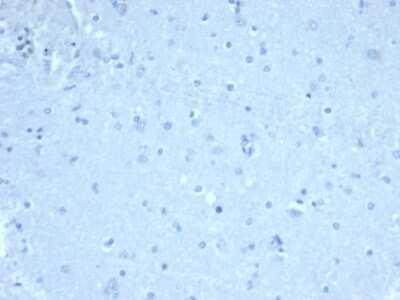 Immunohistochemistry-Paraffin: FoxP1 Antibody (FOXP1/44R) - Azide and BSA Free [NBP3-08470]