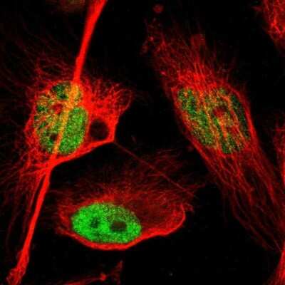 Immunocytochemistry/ Immunofluorescence: FoxP1 Antibody [NBP1-89410]