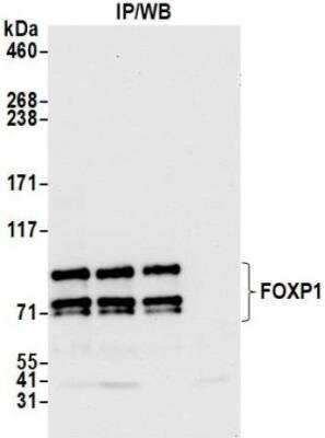 Immunoprecipitation: FoxP1 Antibody (BLR134H) [NBP3-14715]