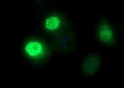 Immunocytochemistry/ Immunofluorescence: FoxP1 Antibody (OTI4F1) - Azide and BSA Free [NBP2-71831]
