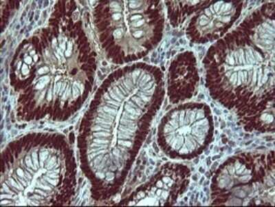 Immunohistochemistry: FoxP1 Antibody (OTI4F1) - Azide and BSA Free [NBP2-71831]