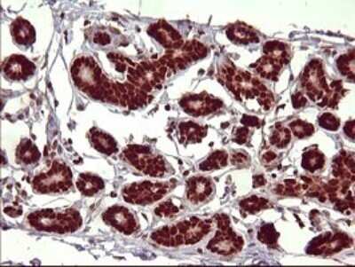 Immunohistochemistry: FoxP1 Antibody (OTI4F1) - Azide and BSA Free [NBP2-71831]