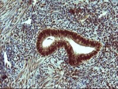 Immunohistochemistry: FoxP1 Antibody (OTI4F1) - Azide and BSA Free [NBP2-71831]