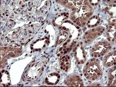 Immunohistochemistry: FoxP1 Antibody (OTI4F1) - Azide and BSA Free [NBP2-71831]