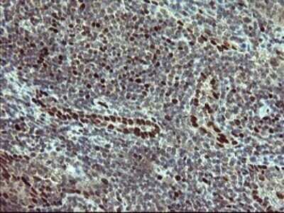 Immunohistochemistry: FoxP1 Antibody (OTI4F1) - Azide and BSA Free [NBP2-71831]