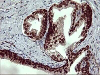 Immunohistochemistry: FoxP1 Antibody (OTI4F1) - Azide and BSA Free [NBP2-71831]