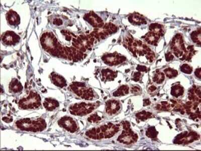 Immunohistochemistry: FoxP1 Antibody (OTI4F1) [NBP2-45713]