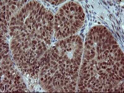 Immunohistochemistry: FoxP1 Antibody (OTI4F1) [NBP2-45713]