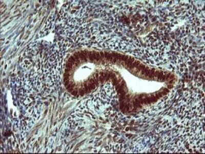 Immunohistochemistry: FoxP1 Antibody (OTI4F1) [NBP2-45713]