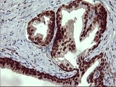 Immunohistochemistry: FoxP1 Antibody (OTI4F1) [NBP2-45713]