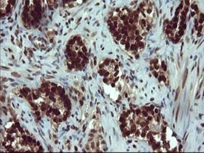 Immunohistochemistry: FoxP1 Antibody (OTI4F1) [NBP2-45713]