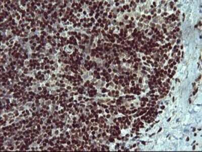 Immunohistochemistry: FoxP1 Antibody (OTI4F1) [NBP2-45713]