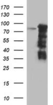 Western Blot: FoxP1 Antibody (OTI4F1) [NBP2-45713]