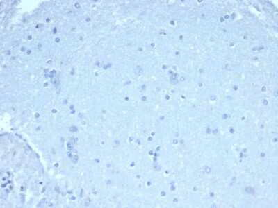 Immunohistochemistry-Paraffin: FoxP1 Antibody (rFOXP1/6902) [NBP3-13927]