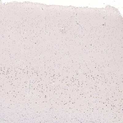 Immunohistochemistry-Paraffin: FoxP2 Antibody (CL5310) [NBP2-61412]