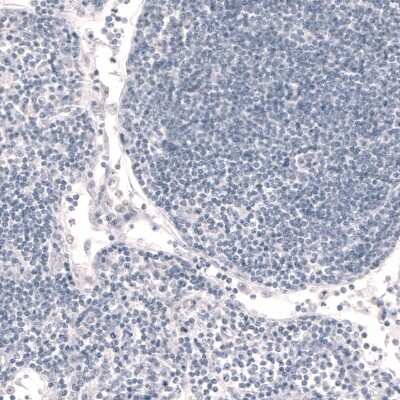 Immunohistochemistry-Paraffin: FoxP2 Antibody (CL5310) [NBP2-61412]