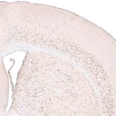 Immunohistochemistry-Paraffin: FoxP2 Antibody (CL5312) [NBP2-61413]