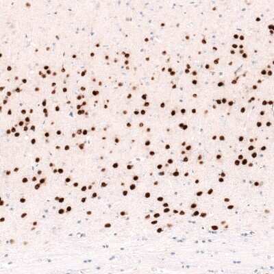 Immunohistochemistry-Paraffin: FoxP2 Antibody (CL5312) [NBP2-61413]