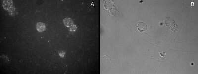 Immunocytochemistry: FoxP3 Antibody [NB600-242]