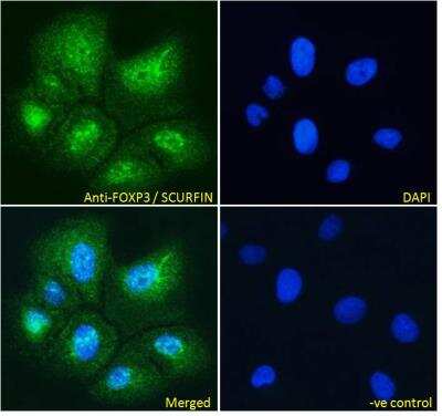 Immunofluorescence: FoxP3 Antibody [NB600-242]