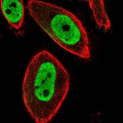 Immunocytochemistry/ Immunofluorescence: FoxP3 Antibody [NBP2-58697]
