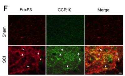 Immunohistochemistry: FoxP3 Antibody - BSA Free [NB100-39002]